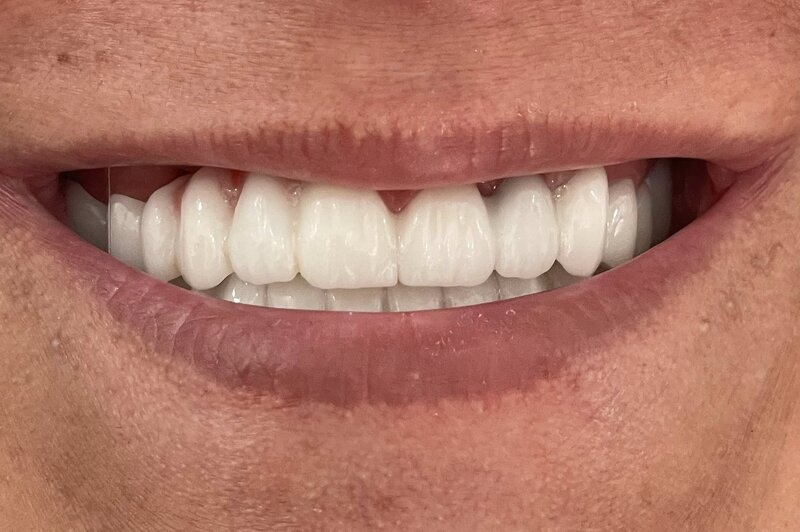 White Dent - Clinica Stomatologica